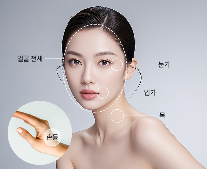 시술부위