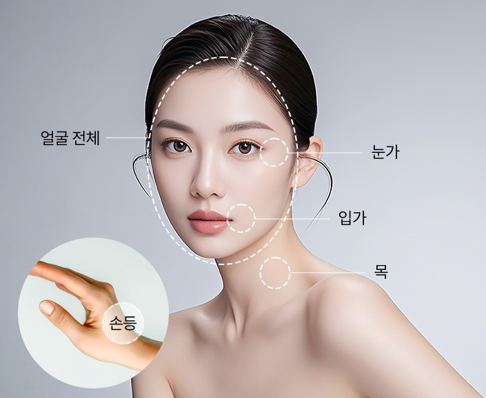 시술부위
