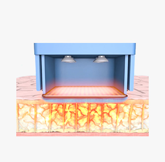 step02 이미지