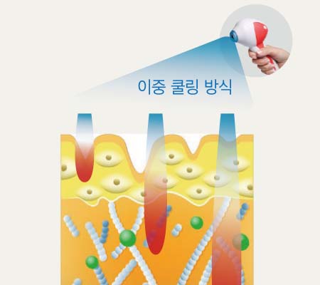 Point 02 이미지