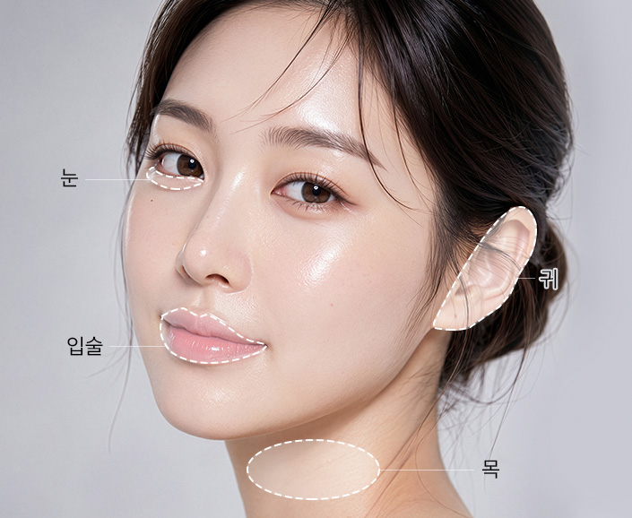 시술부위