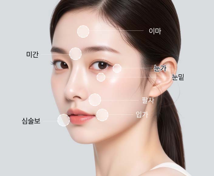 시술부위