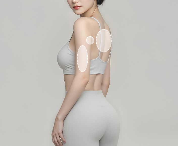 시술부위