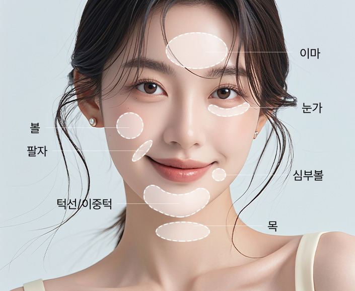 시술부위