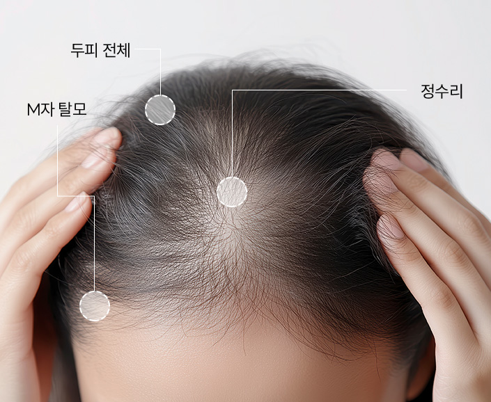 시술부위